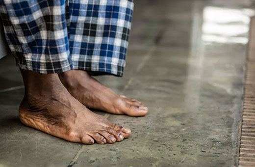 Peripheral Neuropathy