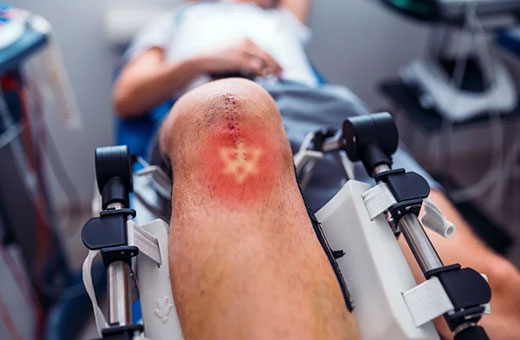 Postsurgical Recovery